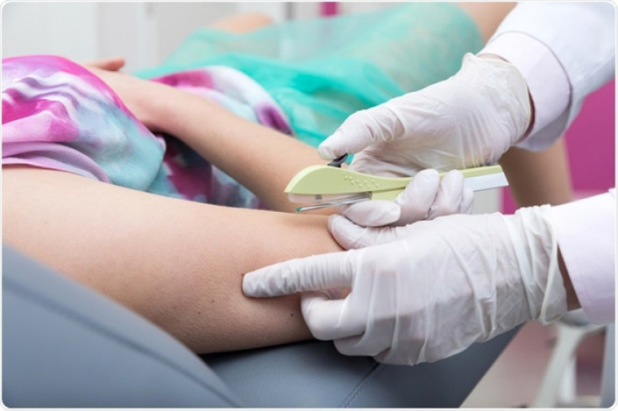 Tocantins vai capacitar 320 profissionais para ampliar acesso ao Implanon pelo SUS